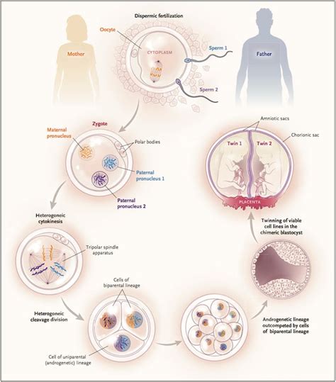 Rare "Semi-Identical" Australian Twins Share 89 Percent of DNA