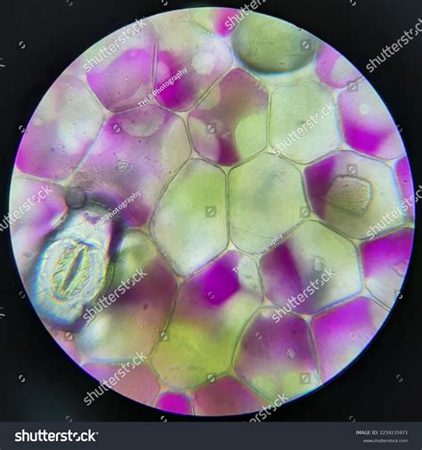 Plasmolysis Shutterstock