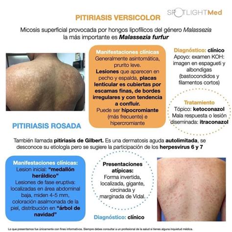 Micosis superficiales y profundas 2 Dermatología Estudiante de