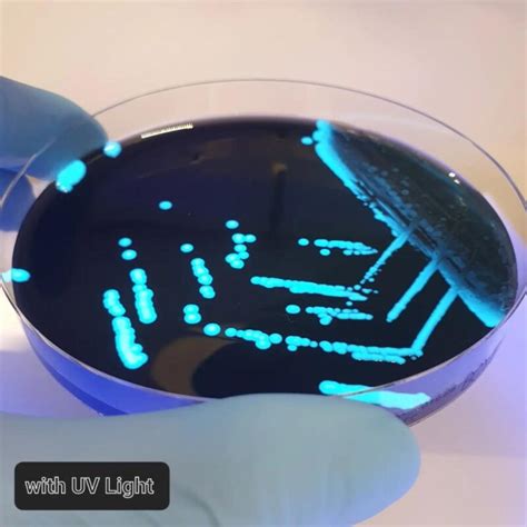 Legionella Bcye Agar Ewc Diagnostics