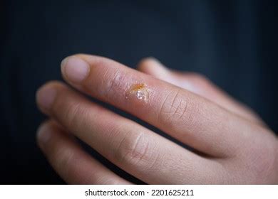 Scalding Hot Water Images Stock Photos Vectors Shutterstock