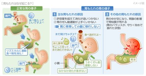 胃もたれの症状・原因｜くすりと健康の情報局