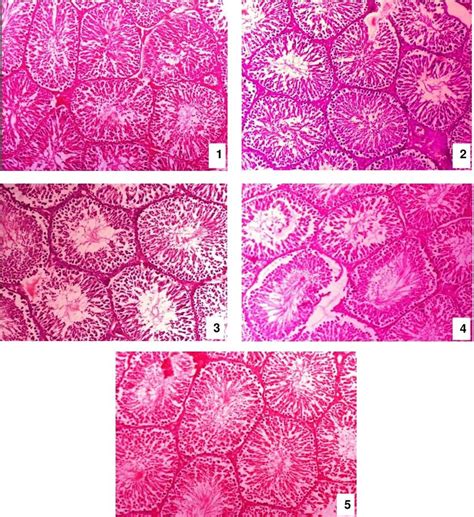 Photomicrograph 1 Group A X 100 He Testis Of Control Rats Showing Download Scientific