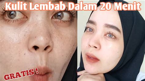 Mengatasi Kulit Kering Gatal And Mengelupas Youtube