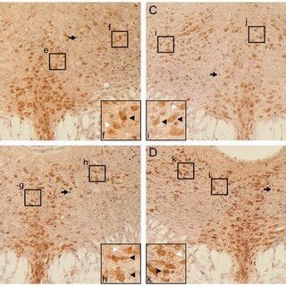 Morphological And Histological Analysis Of Chrd Newborn Mice