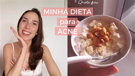 Como Fazer DETOX Para ACNE Tudo O Que Eu Como Em Uma Semana Chez