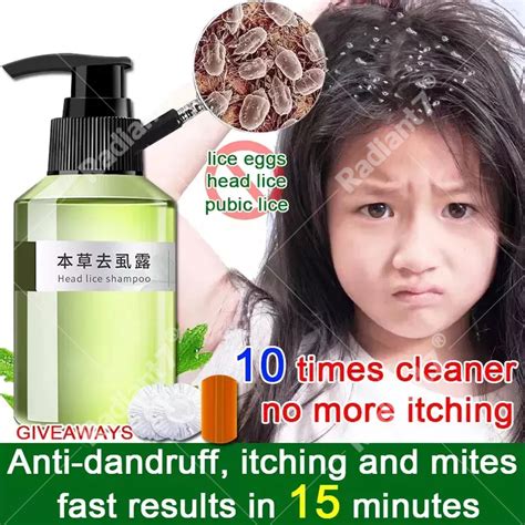 100ml Lice Remover Shampoo Licealiz Head Lice Treatment Shampoo