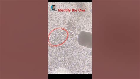 Identify The Ova Of Intestinal Protozoa Stool Routine Examination Youtube