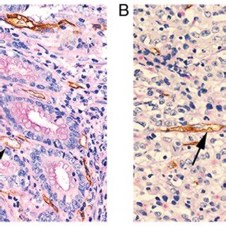 Identifying Endothelium Dependent Vessels And Vm By Cluster Of