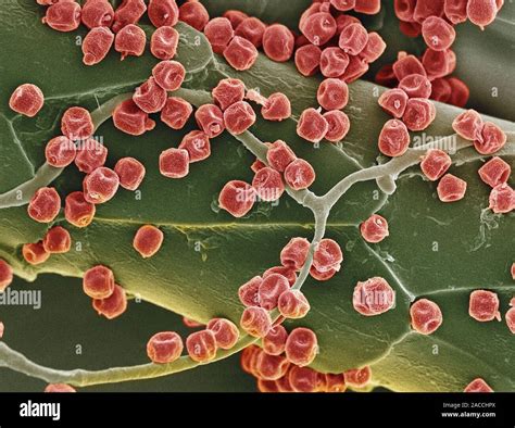 Las Esporas Fúngicas Color Análisis Micrografía De Electrones Sem De