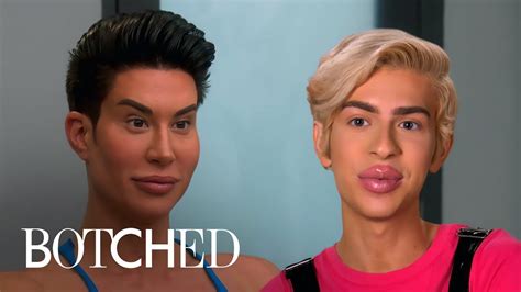 Real Life Barbie And Ken Fix Botched Surgeries Botched E Youtube