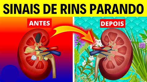 O Que Acontece Quando Os Rins Param De Funcionar - 5 SINTOMAS QUE SEUS RINS ESTÃO PARANDO DE FUNCIONAR - YouTube