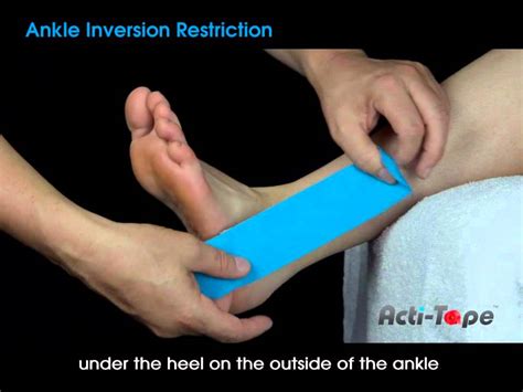 Inversion Ankle Sprain Taping