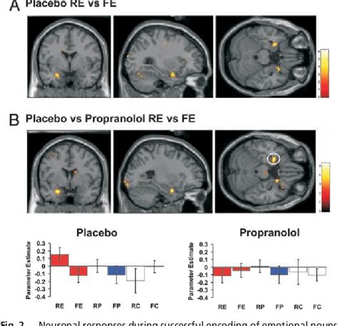 Figure From Beta Adrenergic Modulation Of Emotional Memory Evoked