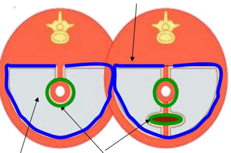 Diagram Of Peritoneum And Peritoneal Cavity Quizlet