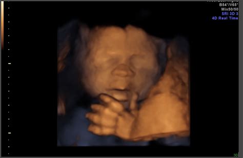 [最新] 24 weeks pregnant ultrasound 3d 214767-Can you get a 3d ultrasound ...