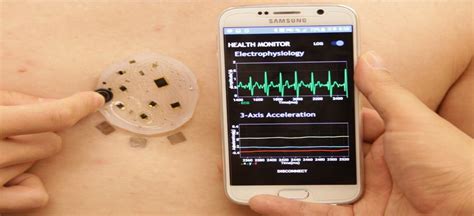 Flexible Electronic Skin Patch Provides Wearable Health Monitoring