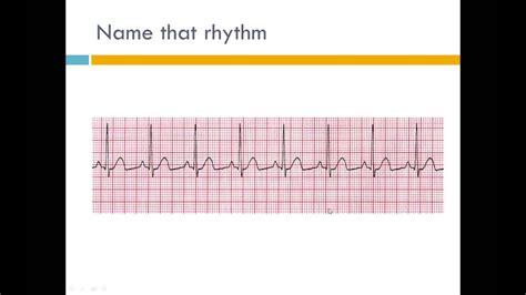 Ekg Interpretation Ppt Pptx Youtube