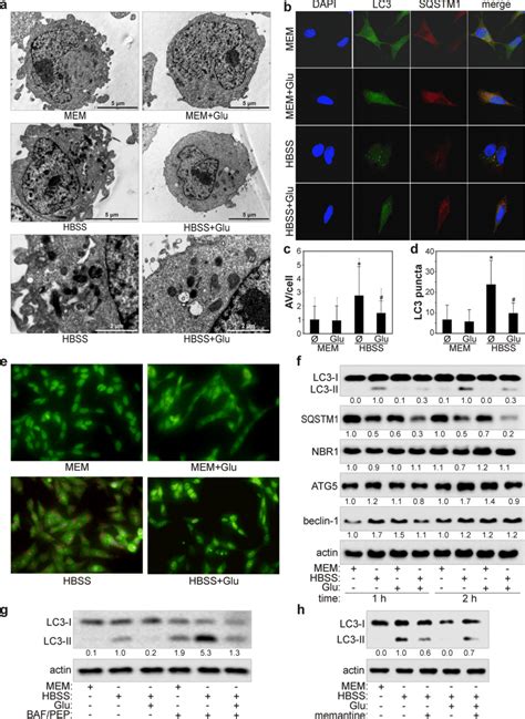 Glutamate Inhibits Starvation Induced Autophagy In Sh Sy Y Cells Af