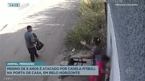 Menino de oito anos é atacado por cadela Pitbull na porta de casa em