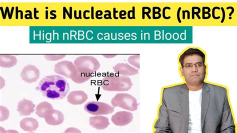 Nucleated Red Blood Cells Nrbcs Lab Tests Guide 58 Off