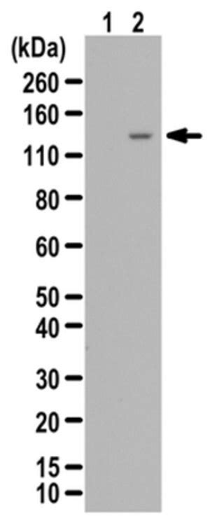 Anti Phospho ULK1 Antibody Ser777 From Rabbit Purified By Affinity