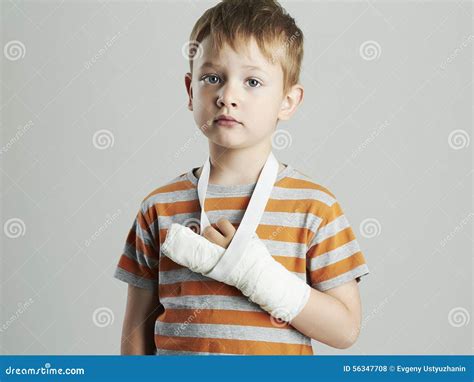 Little Boy In A Castchild With A Broken Armaccident Stock Photo