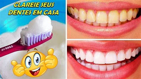 Sorria Esses Rem Dios Naturais Para Clareamento Dos Dentes