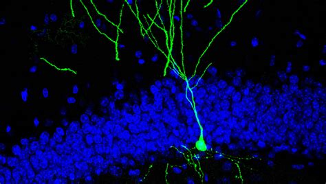 Dendrites 2018 Dendritic Anatomy Molecules And Function