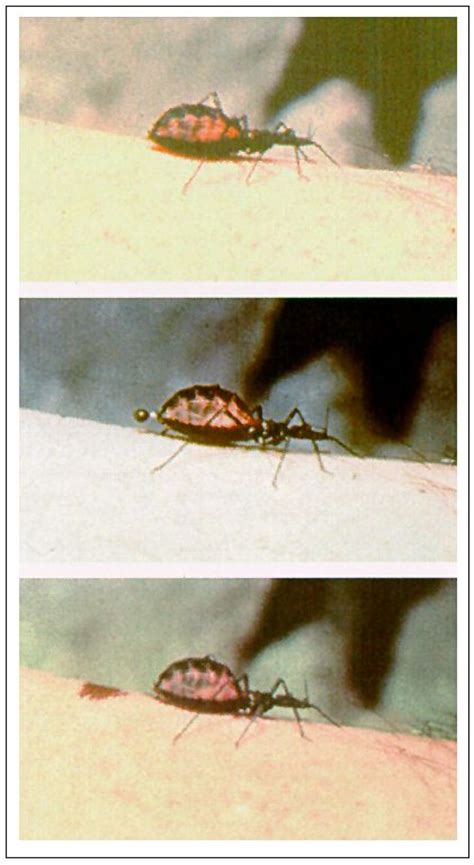 Chagas Disease Kissing Bug That Feeds On Peoples Faces At Night