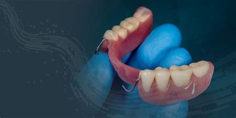 Full Partial Dentures St Petersburg Fl St Pete Implant Center