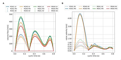 Figure 1 From CT Based Simulation Of Left Ventricular Hemodynamics A