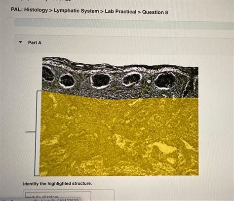 Solved Pal Histology Lymphatic System Lab Practical Chegg