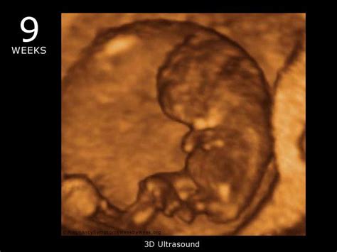 3d Ultrasound At 9 Weeks Pregnant During The 9th Week Of Pregnancy