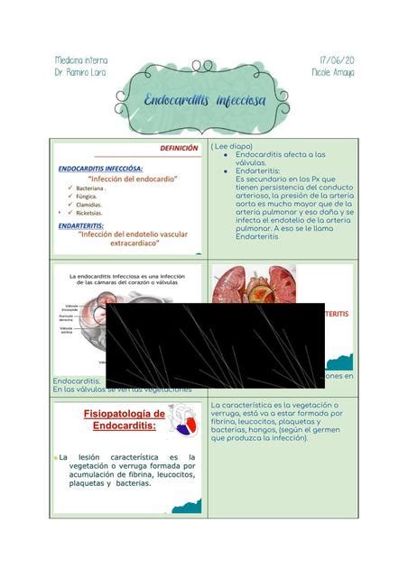 Endocarditis Infecciosa Descripci N Andrea Amaya Udocz