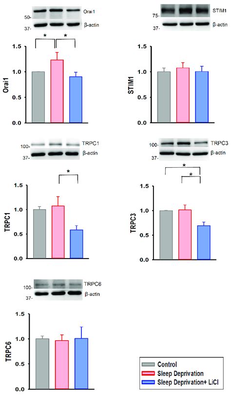 Expression Levels Of Store Operated Ca 2 Entry Channels In REM Sleep