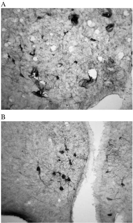 Examples Of Photomicrographs Of Sections Through The Magnocellular