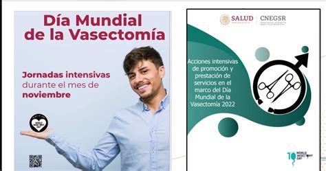 Vasectomía sin bisturí método anticonceptivo permanente y de rápida