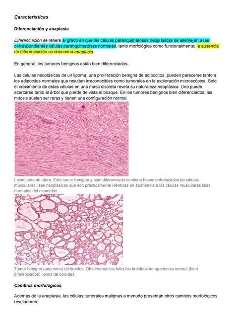 Patologia diferenciacion y anaplasia - Características Diferenciación y ...