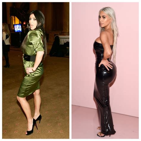 Kim Kardashian Before And After: Plastic Surgery Timeline
