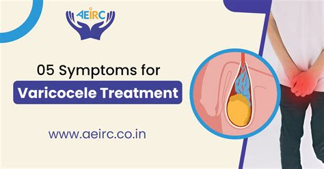 05 Symptoms For Varicocele Treatment Aeirc Clinic