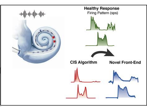 Cochlear Implant Front End Processing Using Machine Learning Cynthia