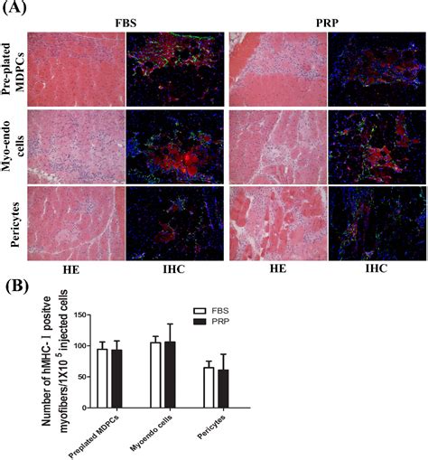 Figure From Platelet Rich Plasma Promotes The Proliferation Of Human