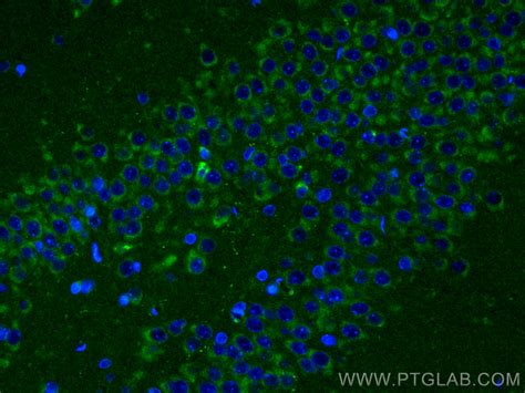 Bnp Antibody 13299 1 Ap Proteintech 武汉三鹰生物技术有限公司