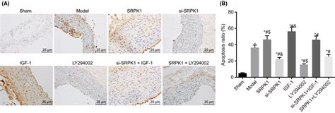 TUNEL Staining 400 Shows That SPRK1 Gene Silencing Reduces VSMC