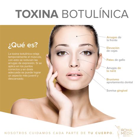 Toxina Botulínica Que es RomaMedic