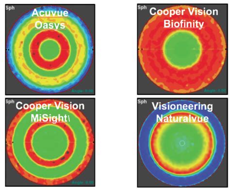 Myopia Control With Multifocal Contact Lenses Modern Optometry