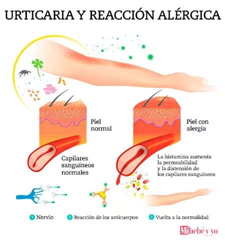 Eliminar ácaros: qué son y cómo conseguirlo