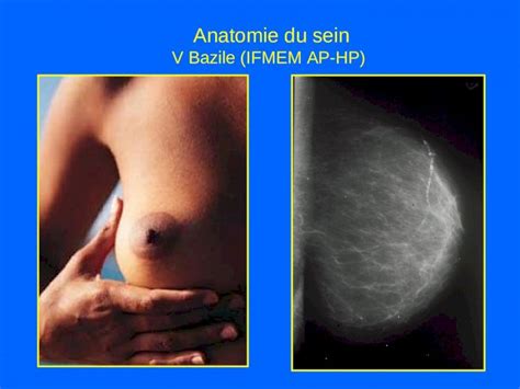 PPT Anatomie Du Sein V Bazile IFMEM AP HP Evolution De La Glande