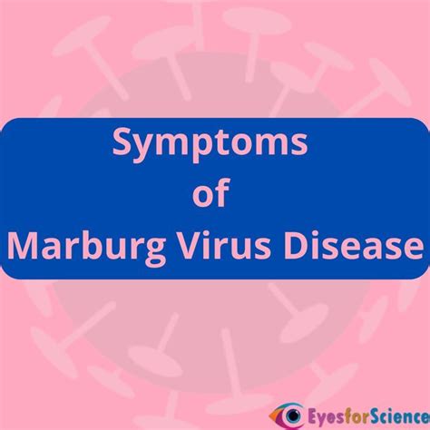Symptoms of Marburg Virus Disease | Virus symptoms, Disease, Marburg